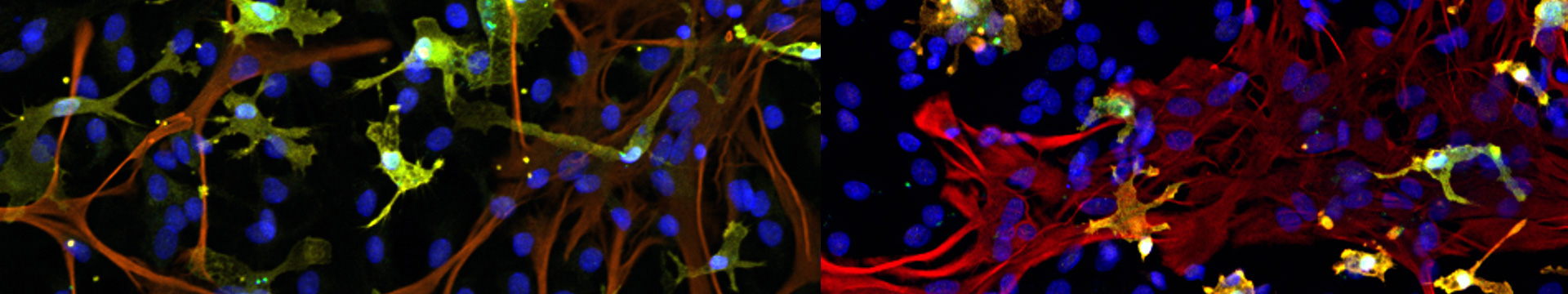 Microglia & neurons
